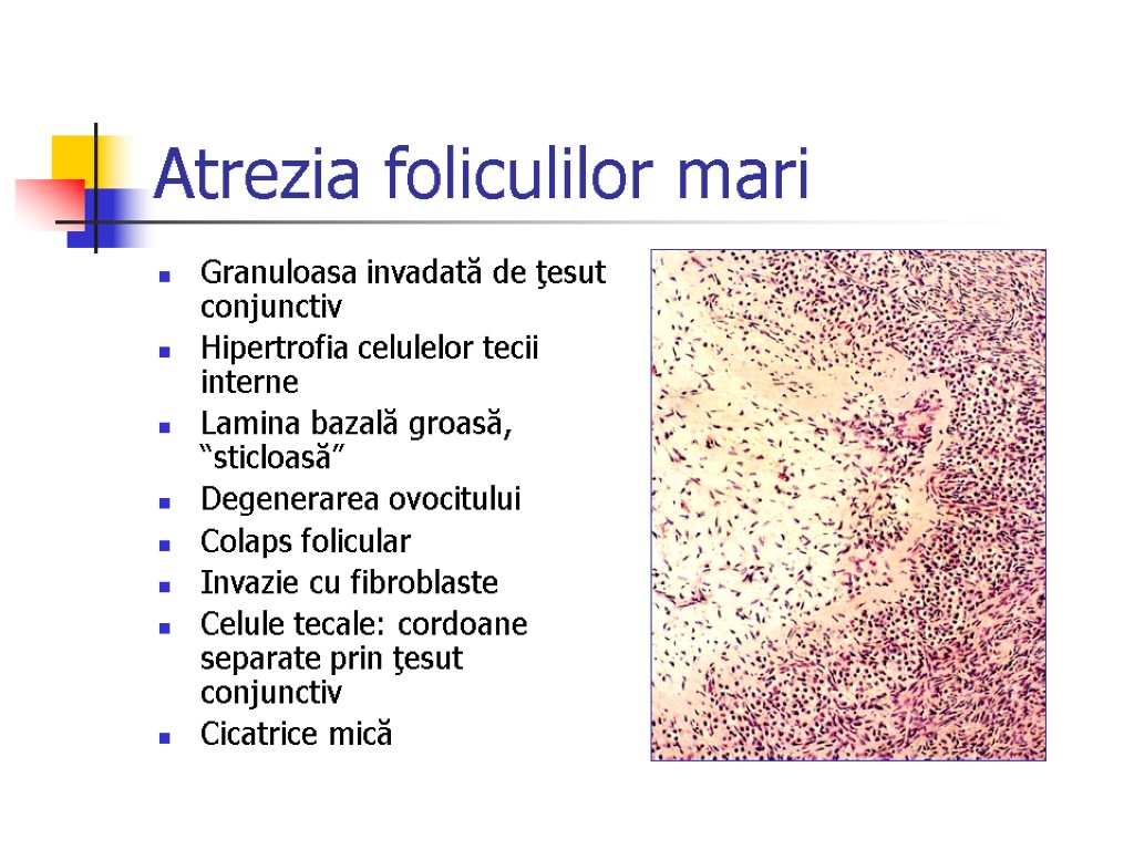 Atrezia foliculilor mari Granuloasa invadată de ţesut conjunctiv Hipertrofia celulelor tecii interne Lamina bazală